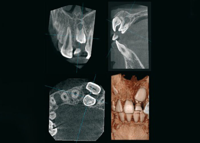 Moderne 3D Diagnostik