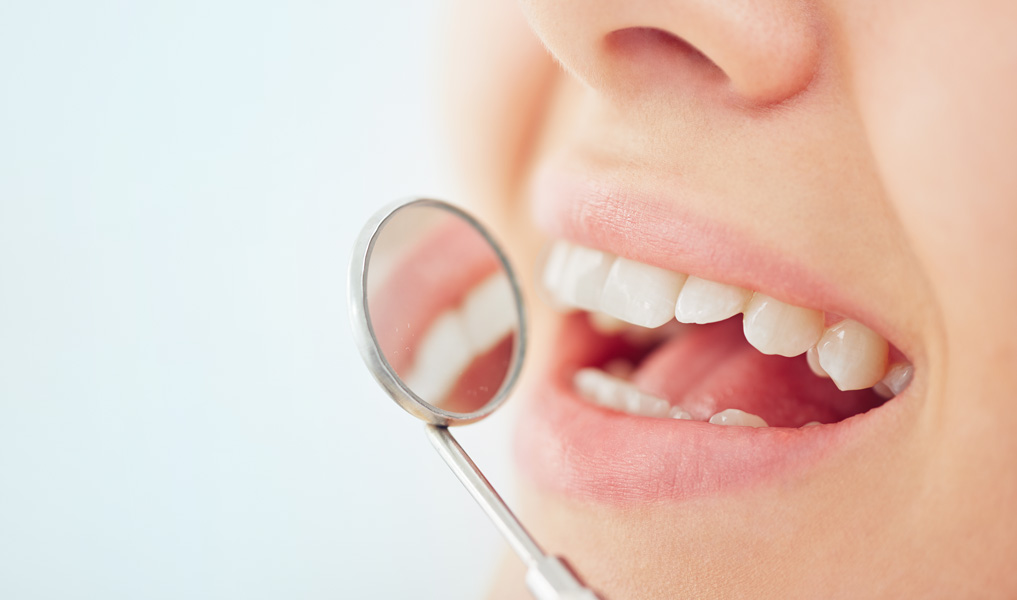News – Zahnimplantate für Patienten