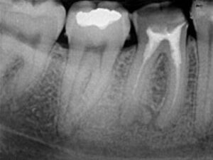 Endodontie