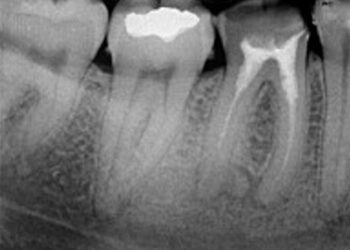 Endodontie