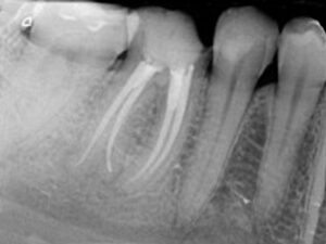 Endodontie