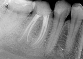 Endodontie