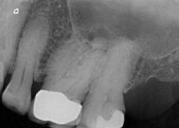 Endodontie