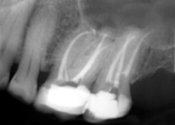 Endodontie