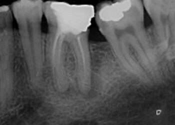 Endodontie