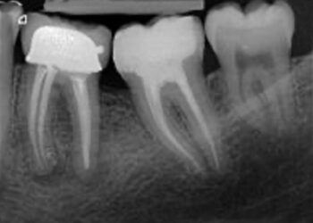 Endodontie