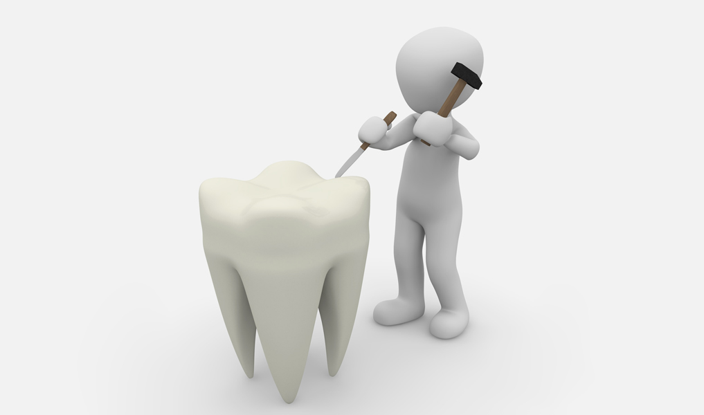 Komplexe Zahnbehandlungen